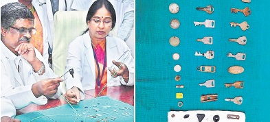 తాళాలు మింగిండు: చెన్నై వ్యక్తి పొట్టలో 40 వస్తువులు