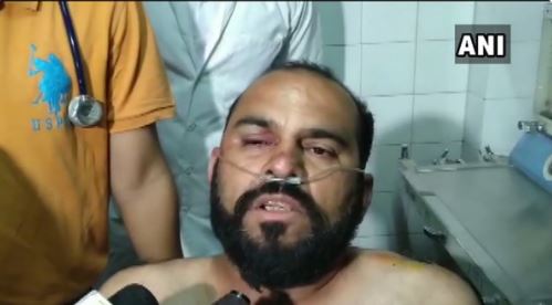 చాలా ఇబ్బందులు పడ్డ..అందుకే హార్దిక్ ను కొట్టా