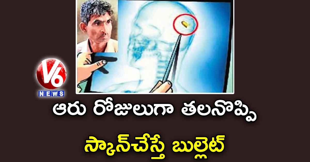 ఆరు రోజులుగా తలనొప్పి..  స్కాన్‌చేస్తే బుల్లెట్‌