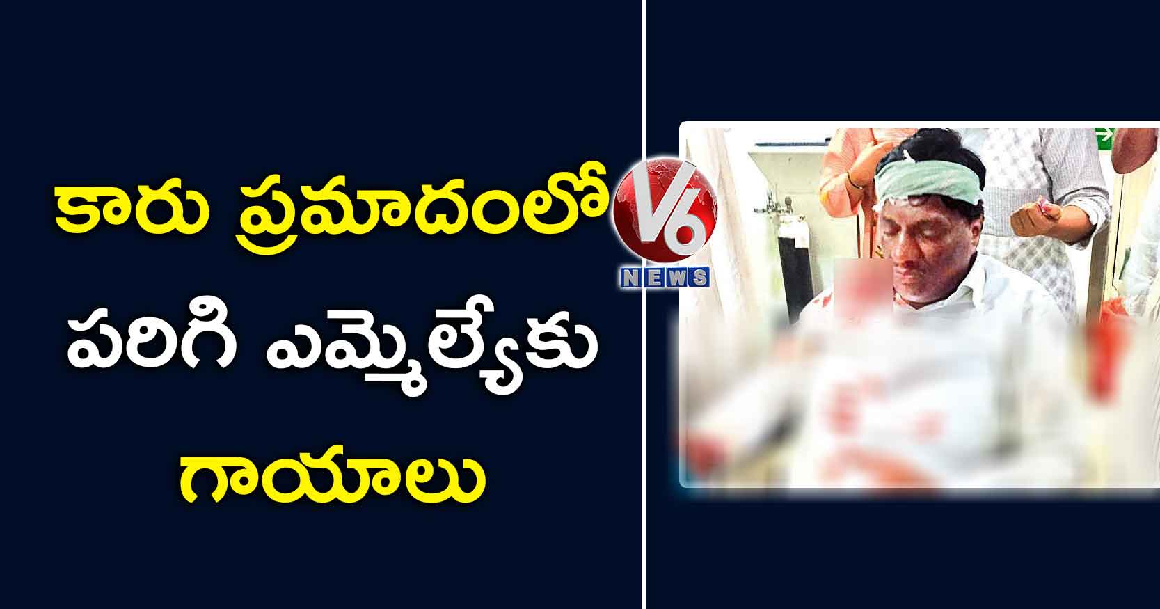 కారు ప్రమాదంలో పరిగి ఎమ్మెల్యేకు గాయాలు