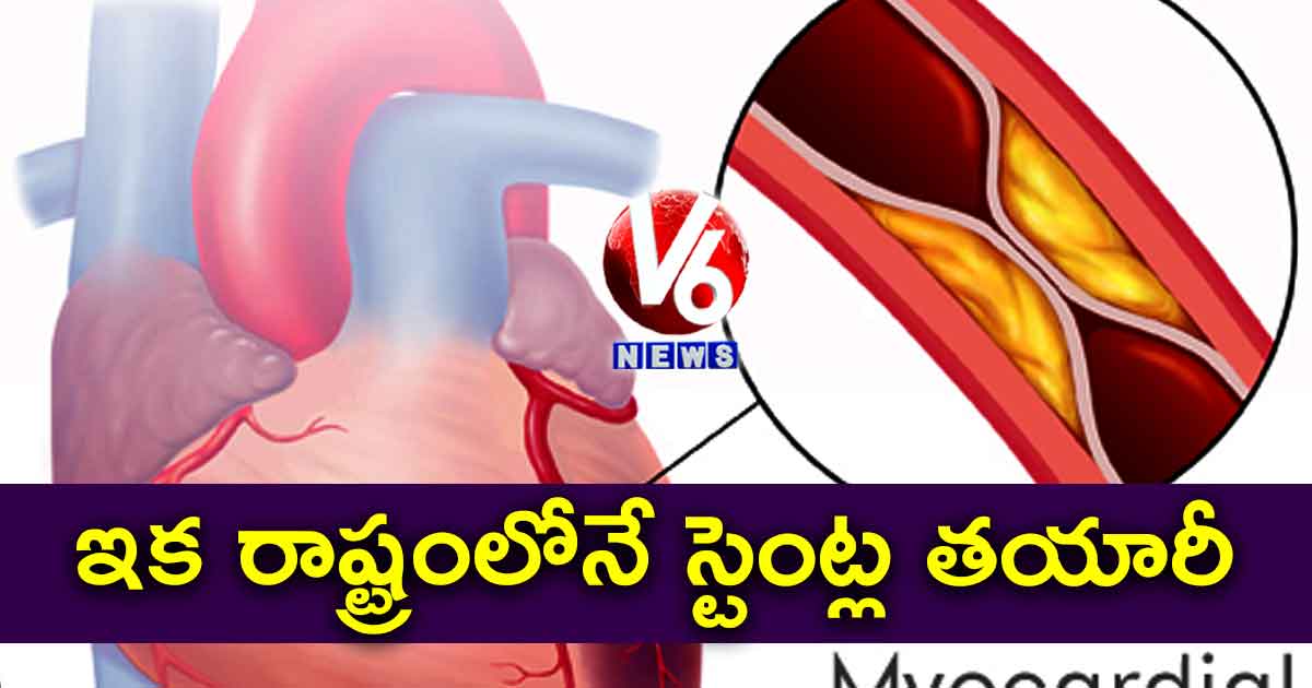 ఇక రాష్ట్రంలోనే స్టెంట్ల తయారీ