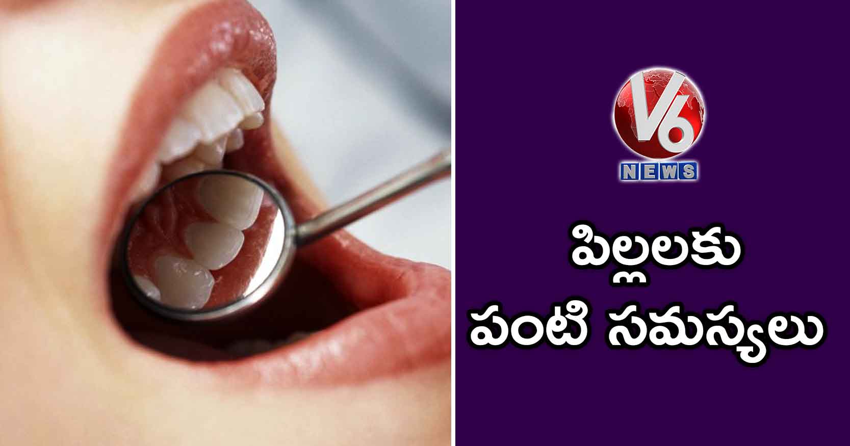 పిల్లలకు పంటి సమస్యలు
