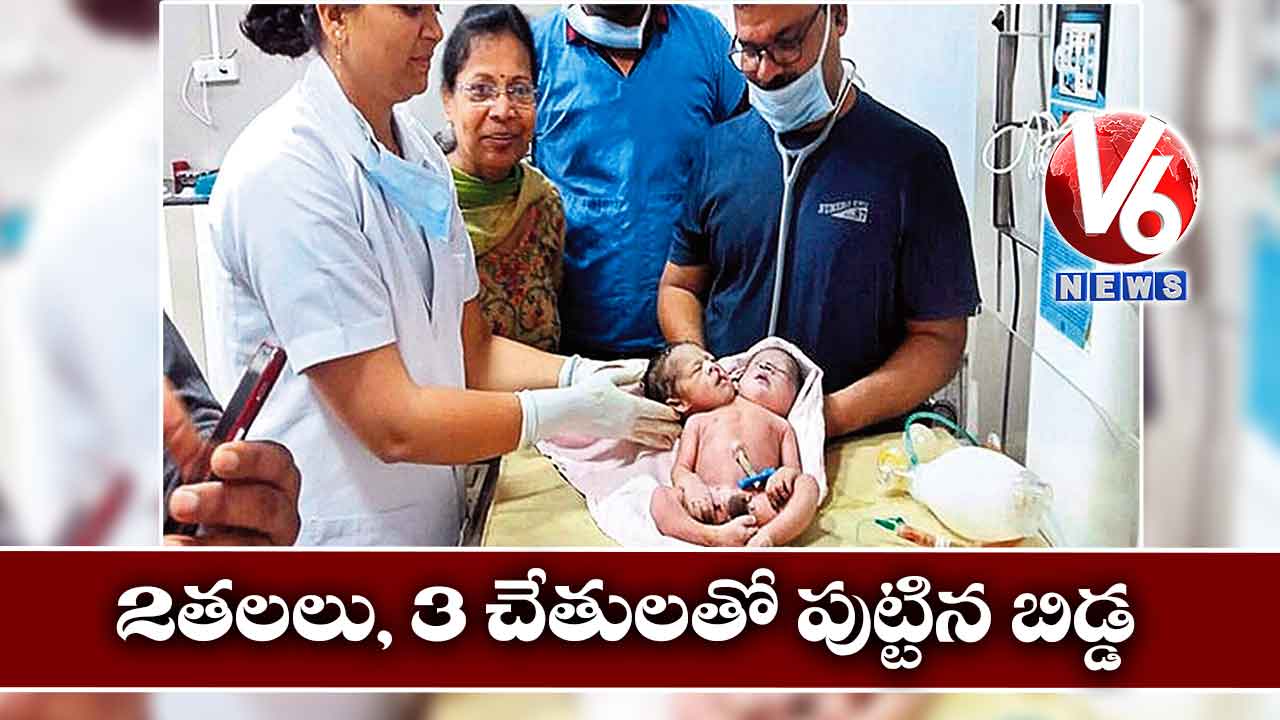 2 తలలు, 3 చేతులతో పుట్టిన బిడ్డ