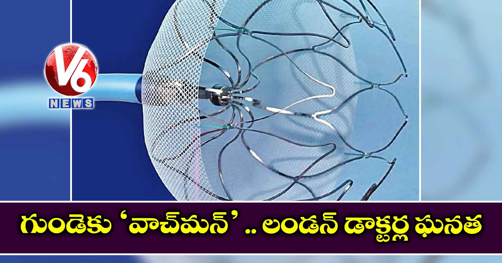 గుండెకు ‘వాచ్మన్’ .. లండన్ డాక్టర్ల ఘనత