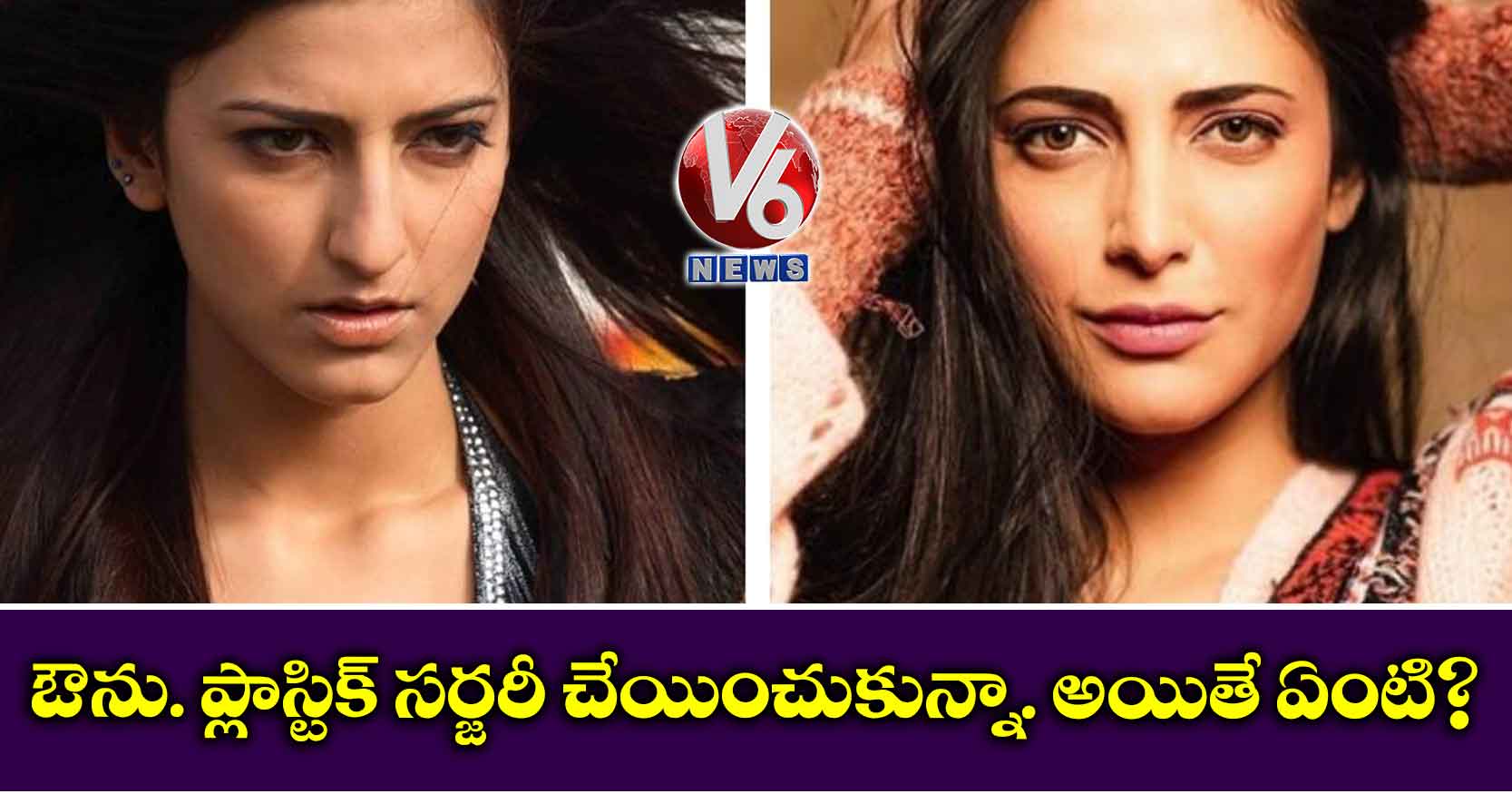 ఔను. ప్లాస్టిక్ సర్జరీ చేయించుకున్నా. అయితే ఏంటి?