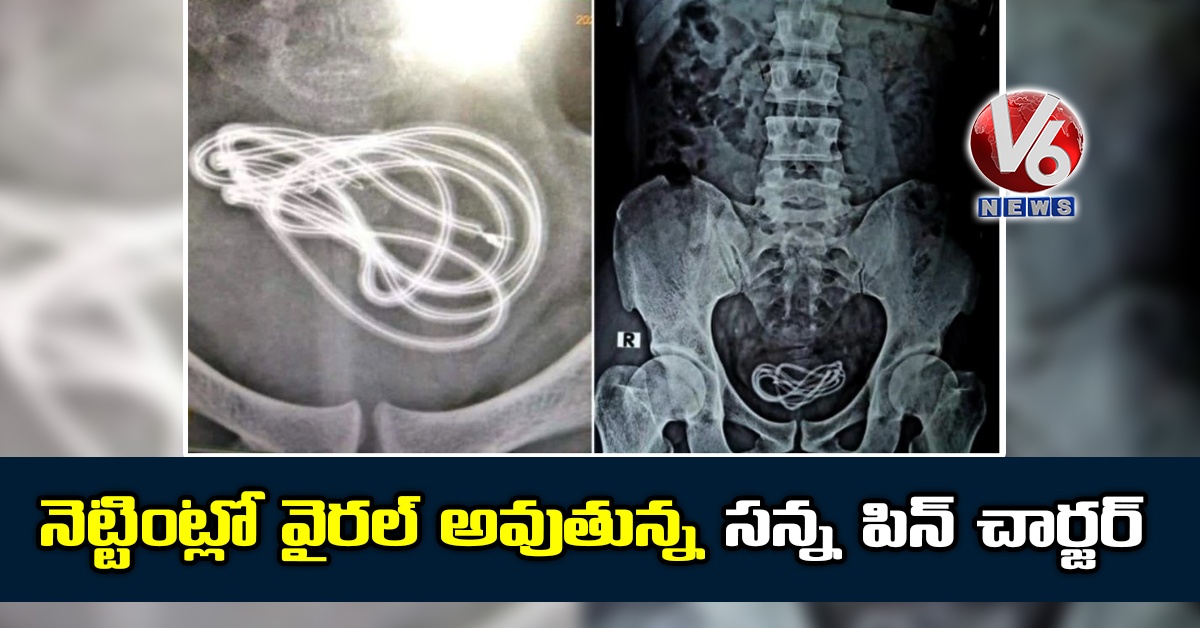 నెట్టింట్లో వైరల్ అవుతున్న సన్న పిన్ చార్జర్