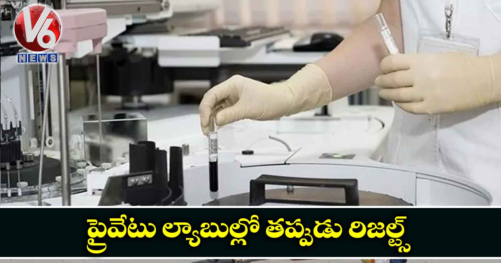 ప్రైవేటు ల్యాబుల్లో తప్పుడు రిజల్ట్స్