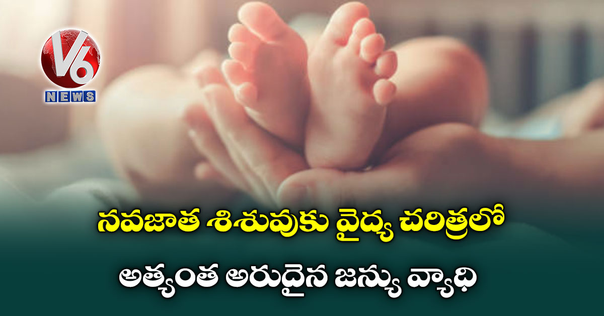 నవజాత శిశువుకు వైద్య చరిత్రలో అత్యంత అరుదైన జన్యు వ్యాధి