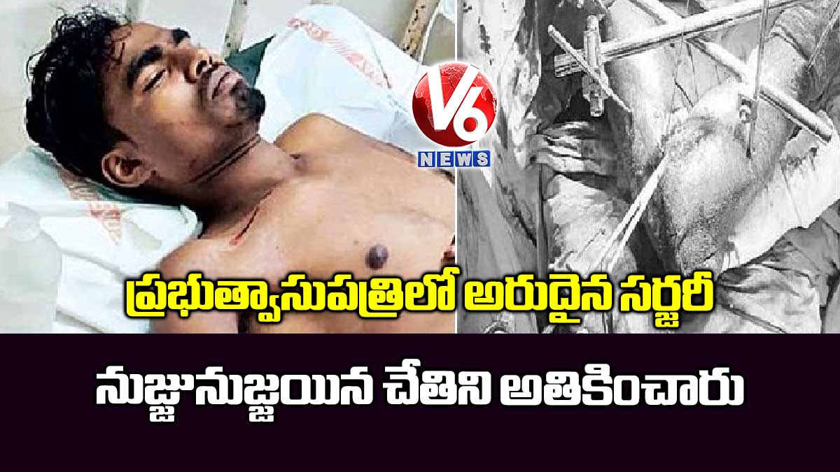 ప్రభుత్వాసుపత్రిలో అరుదైన సర్జరీ:  నుజ్జునుజ్జయిన చేతిని అతికించారు