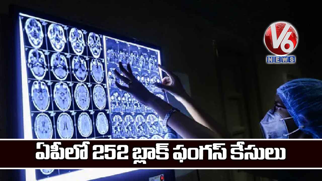 ఏపీలో 252 బ్లాక్ ఫంగ‌స్ కేసులు