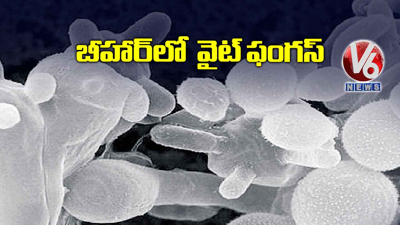 బీహార్లో వైట్ ఫంగస్