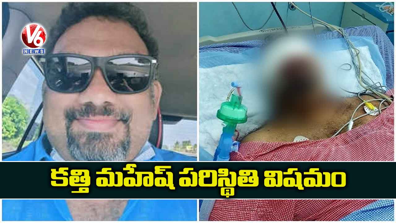 కత్తి మహేష్ పరిస్థితి విషమం