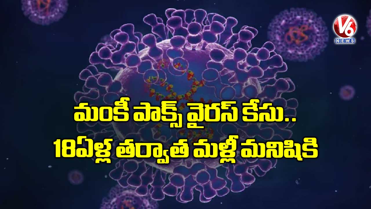 మంకీ పాక్స్ వైరస్ కేసు.. 18 ఏళ్ల తర్వాత మళ్లీ మనిషికి