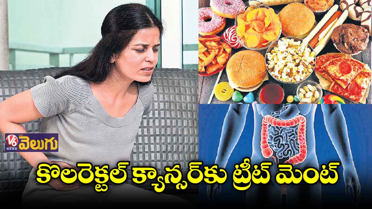 జంక్ ఫుడ్ ఎక్కువ తినడం వల్ల కొలరెక్టల్‌‌ క్యాన్సర్‌‌‌‌!