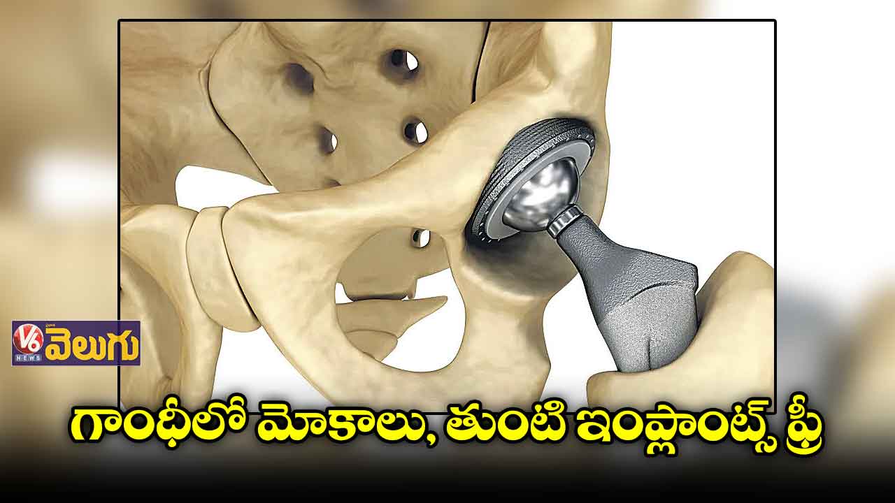 మోకాలు, తుంటి మార్పిడి పేషెంట్లకు ఇంప్లాంట్స్ ఫ్రీ