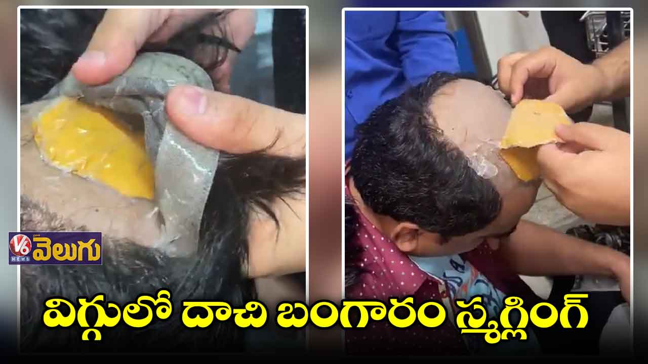 బట్టతలలో బంగారం స్మగ్లింగ్