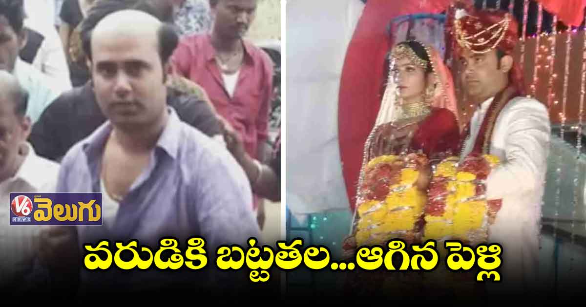 వరుడి బట్టతల చూసి వధువు షాక్.. ఆగిన పెళ్లి