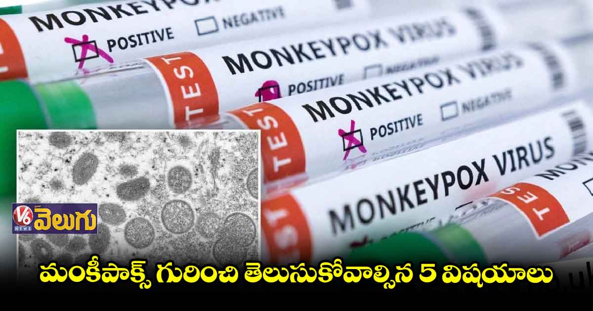 మంకీపాక్స్ గురించి తెలుసుకోవాల్సిన 5 విషయాలు
