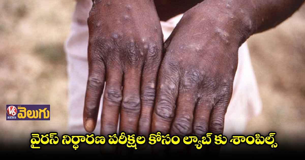కేరళలో మంకీపాక్స్ కలకలం