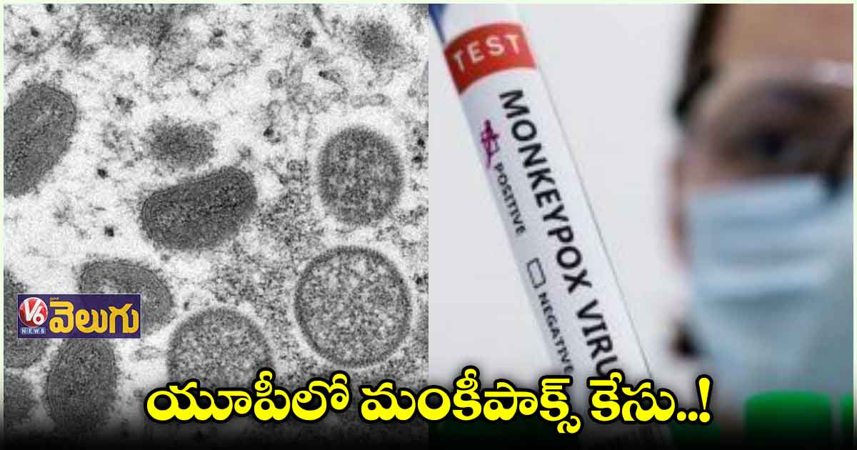 ఉత్తర్ ప్రదేశ్లో మంకీపాక్స్ కలకలం
