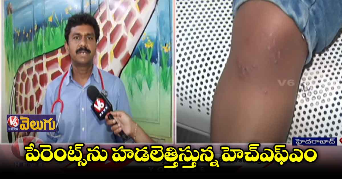 చిన్నారుల్లో హెచ్ఎఫ్ఎం డిసీజ్