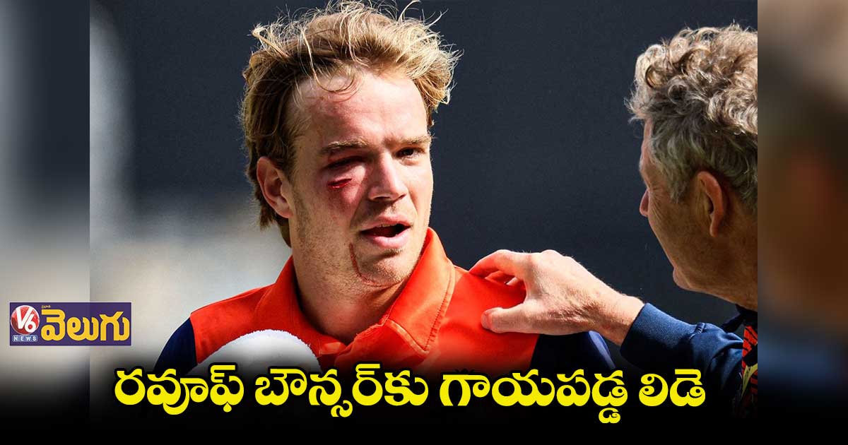 రవూఫ్ రాకాసి బౌన్సర్..నెదర్లాండ్స్ బ్యాట్స్మన్కు గాయం