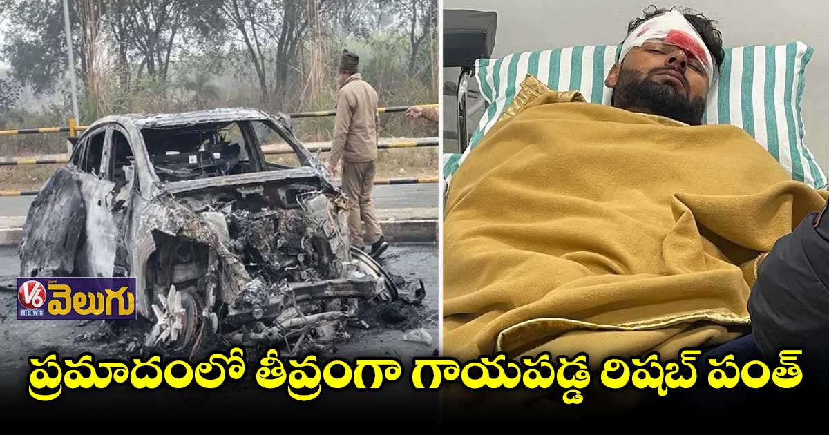 క్రికెటర్ రిషబ్ పంత్కు తీవ్ర గాయాలు