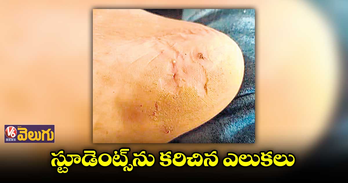 రెసిడెన్షియల్ స్కూల్లో స్టూడెంట్స్ను కరిచిన ఎలుకలు