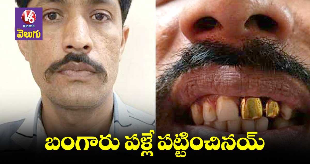 పరారీలో ఉన్న దొంగను పట్టించిన బంగారు పళ్లు