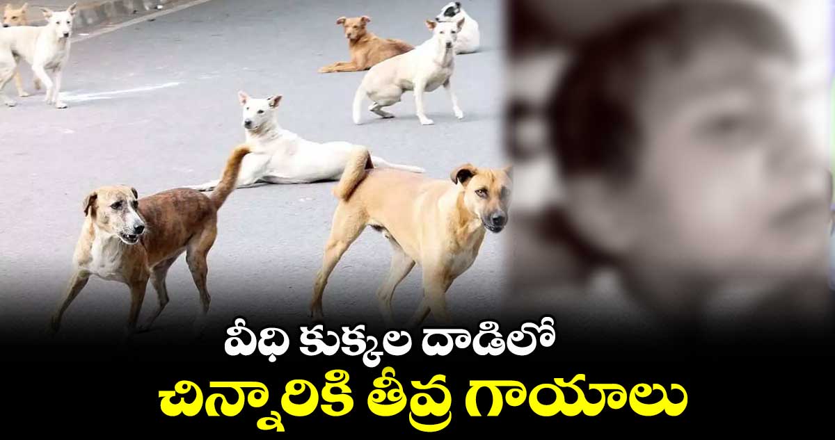 వీధి కుక్కల దాడిలో చిన్నారికి తీవ్ర గాయాలు