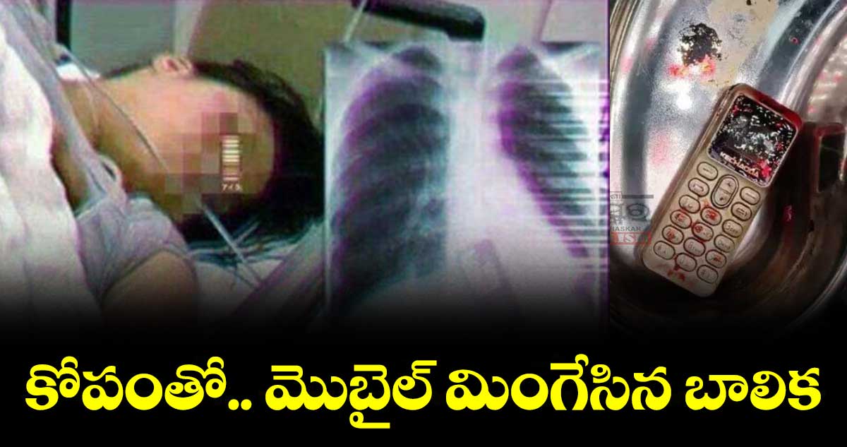 కోపంతో.. మొబైల్ మింగేసిన బాలిక.. తప్పిన ప్రమాదం 