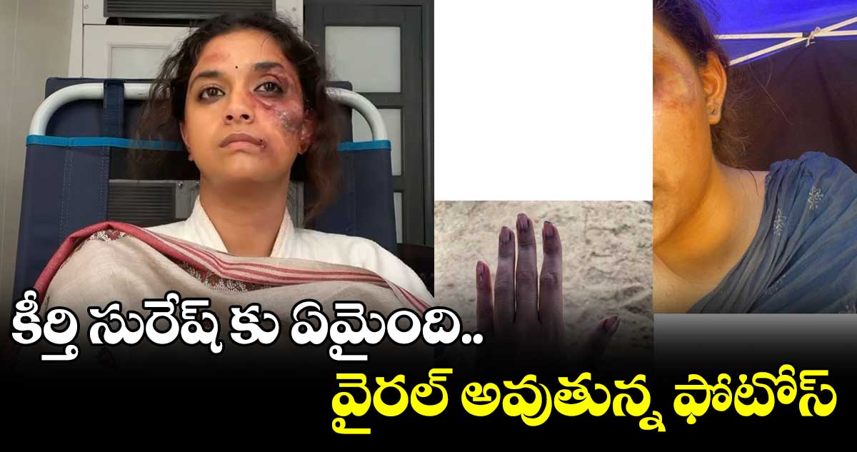 కీర్తి సురేష్ కు ఏమైంది.. వైరల్ అవుతున్న ఫోటోస్