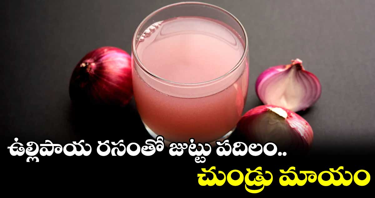 ఉల్లిపాయ రసంతో జుట్టు పదిలం.. చుండ్రు మాయం