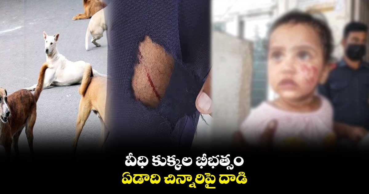 వీధి కుక్కల భీభత్సం.. ఏడాది చిన్నారిపై దాడి