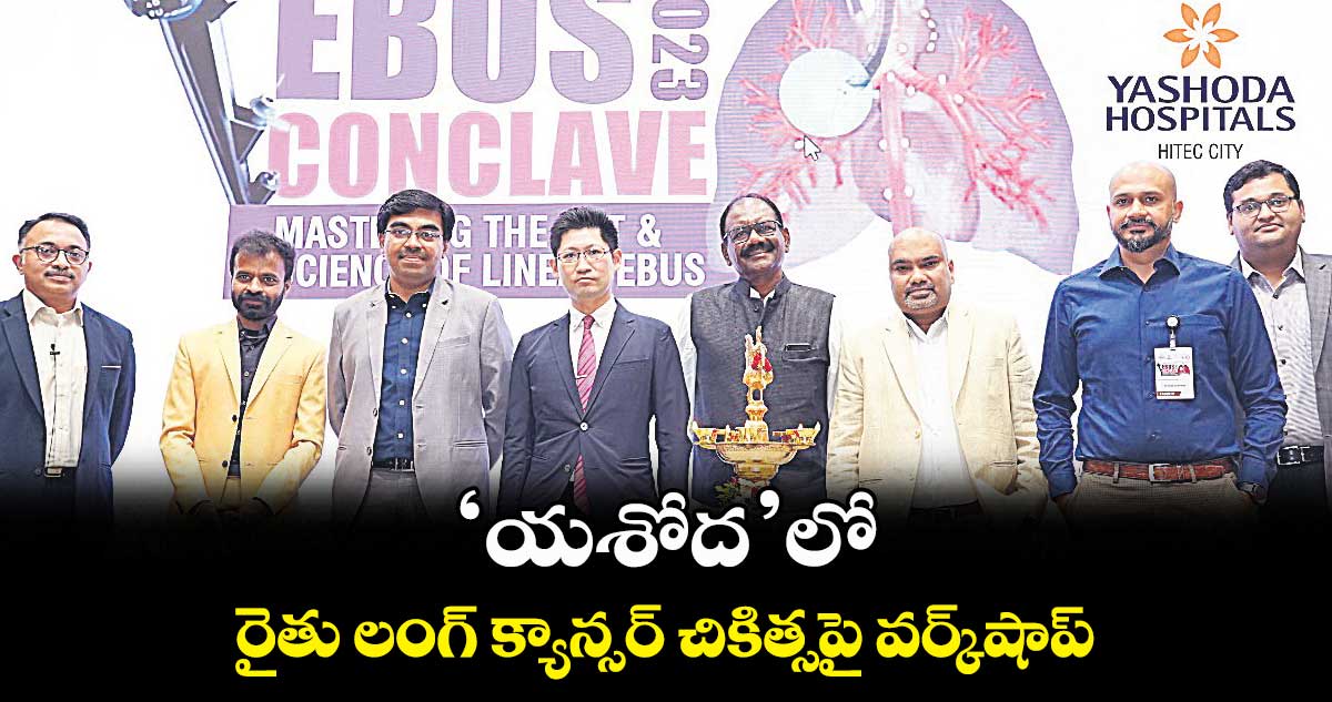 ‘యశోద’లో లంగ్ క్యాన్సర్ చికిత్సపై వర్క్​షాప్