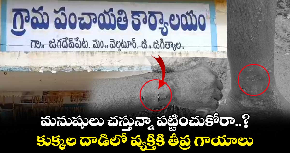 కుక్కల దాడిలో వ్యక్తికి తీవ్ర గాయాలు.. 