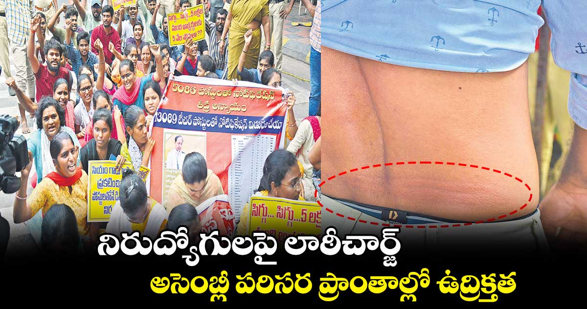నిరుద్యోగులపై లాఠీచార్జ్ .. అసెంబ్లీ పరిసర ప్రాంతాల్లో ఉద్రిక్తత