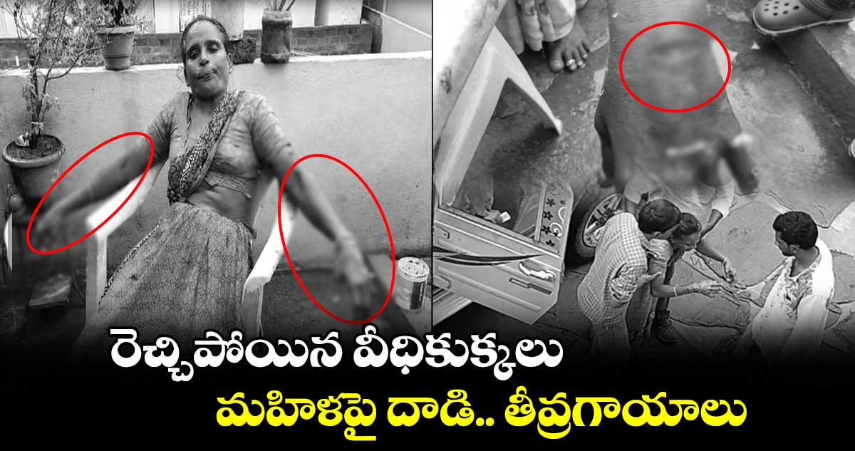 రెచ్చిపోయిన వీధికుక్కలు.. మహిళపై దాడి.. తీవ్రగాయాలు