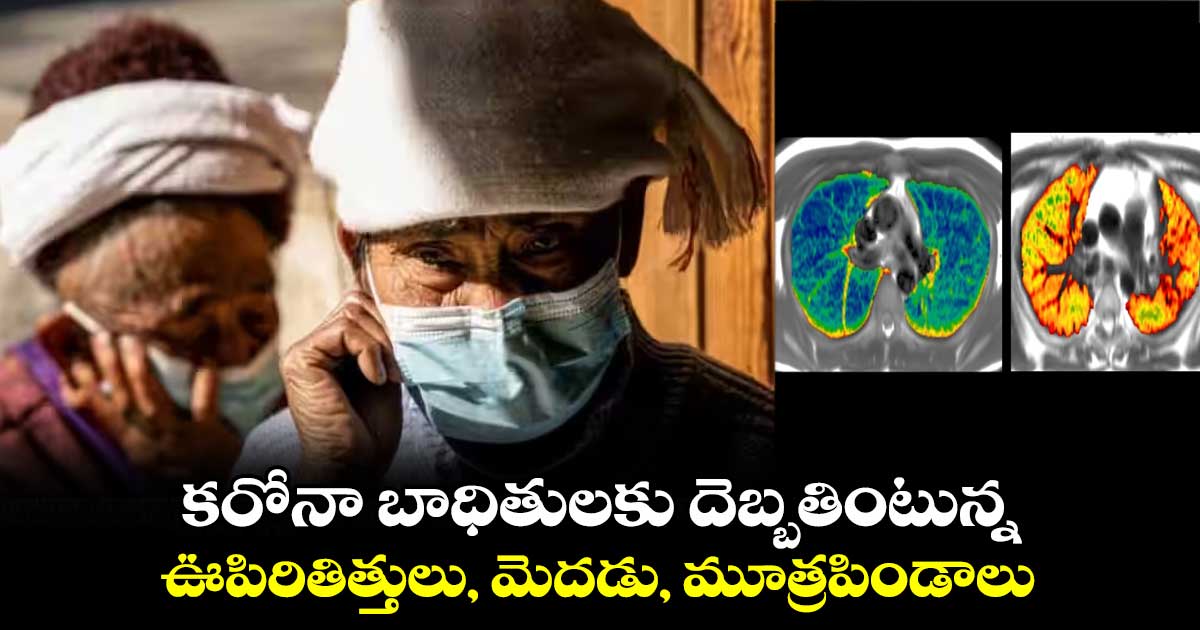 కరోనా బాధితులకు దెబ్బతింటున్న ఊపిరితిత్తులు, మెదడు, మూత్రపిండాలు