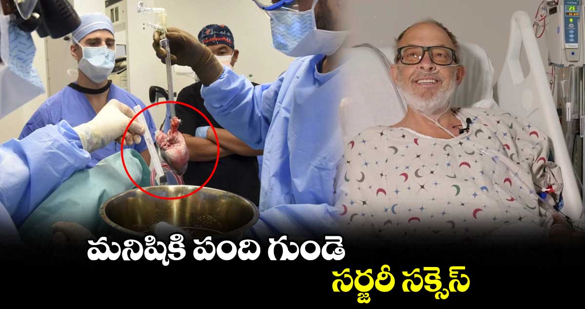 మనిషికి పంది గుండె..సర్జరీ సక్సెస్