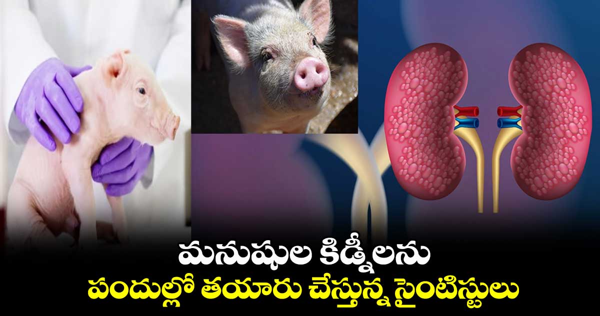 మనుషుల కిడ్నీలను పందుల్లో తయారు చేస్తున్న సైంటిస్టులు