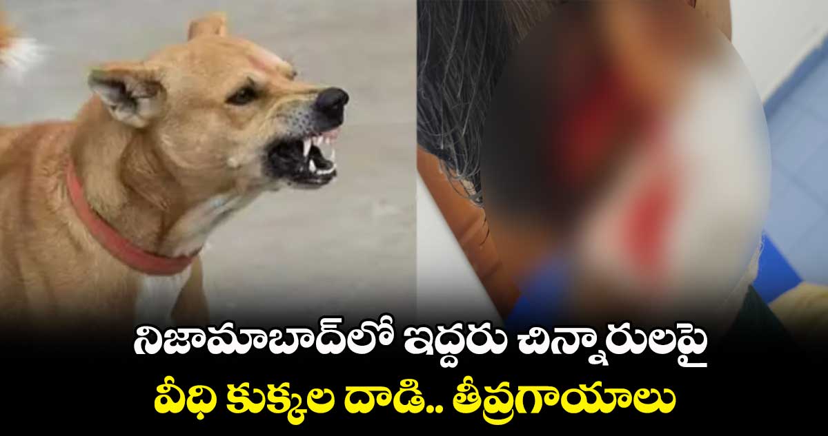 నిజామాబాద్లో ఇద్దరు చిన్నారులపై వీధి కుక్కల దాడి.. తీవ్రగాయాలు