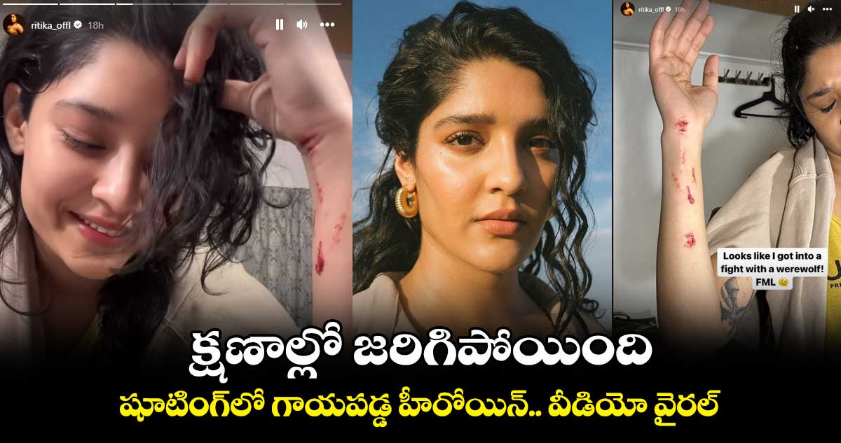 Ritika Singh : క్షణాల్లో జరిగిపోయింది..షూటింగ్లో గాయపడ్డ హీరోయిన్
