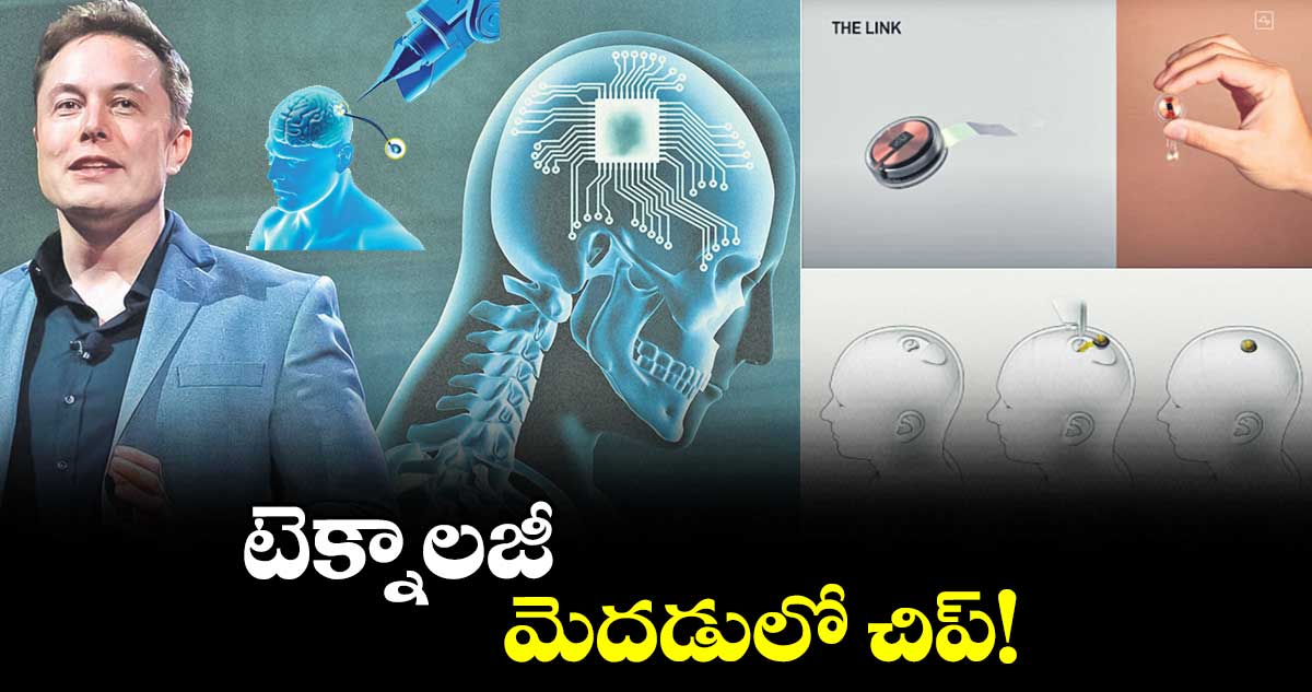 టెక్నాలజీ : మెదడులో చిప్​!