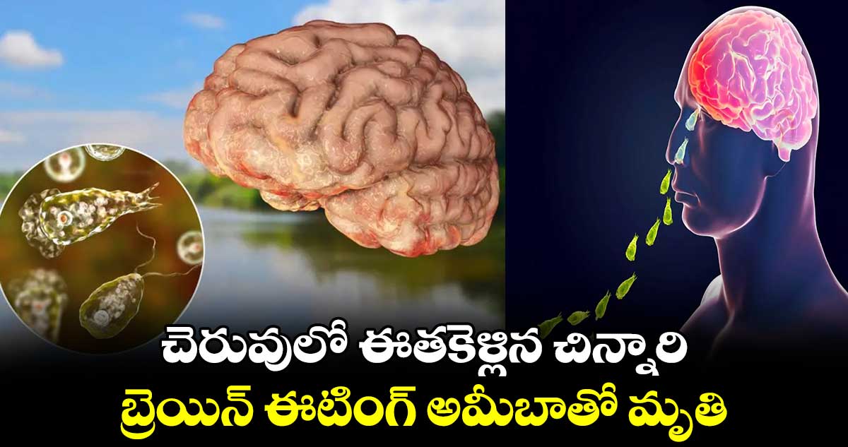చెరువులో ఈతకెళ్లిన చిన్నారి: బ్రెయిన్ ఈటింగ్ అమీబాతో మృతి
