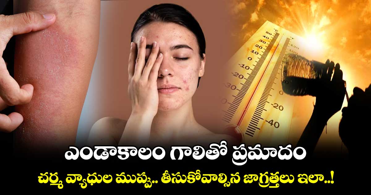 Summer Health : ఎండాకాలం గాలితో ప్రమాదం.. చర్మ వ్యాధుల ముప్పు.. తీసుకోవాల్సిన జాగ్రత్తలు ఇలా..!