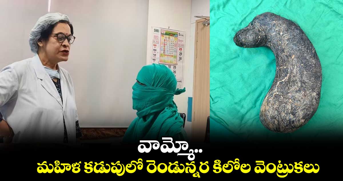 వామ్మో.. మహిళ కడుపులో రెండున్నర కిలోల వెంట్రుకలు 
