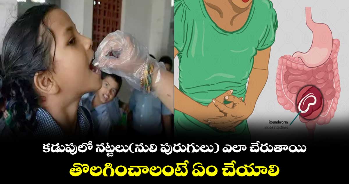 కడుపులో నట్టలు(నులి పురుగులు) ఎలా చేరుతాయి..తొలగించాలంటే ఏం చేయాలి 