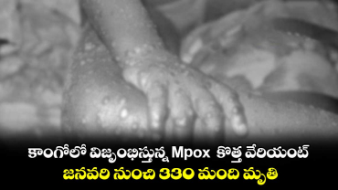 కాంగోలో విజృంభిస్తున్న Mpox .. జనవరి నుంచి 330 మంది మృతి  
