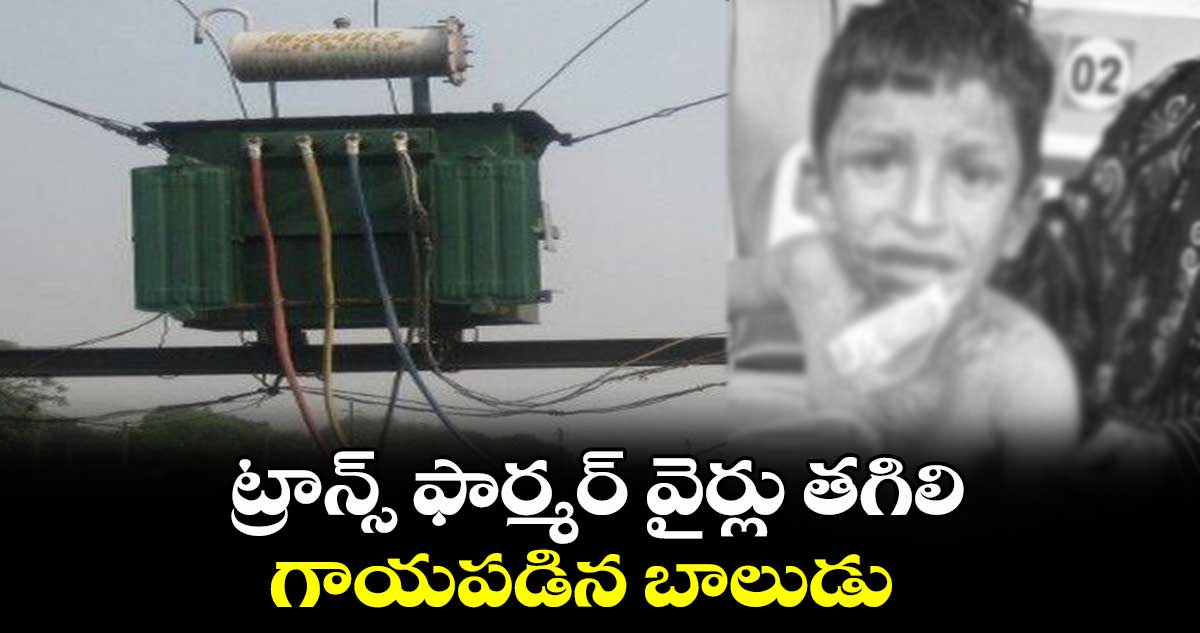 ట్రాన్స్ ఫార్మర్ వైర్లు తగిలి గాయపడిన బాలుడు